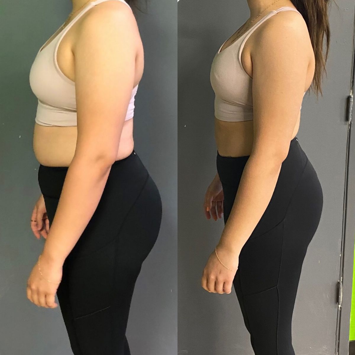 Rosie Care Blue Burn