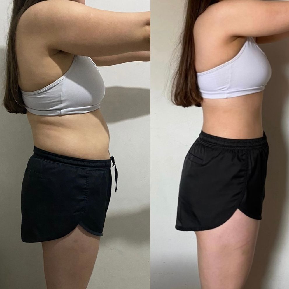 Rosie Care Blue Burn